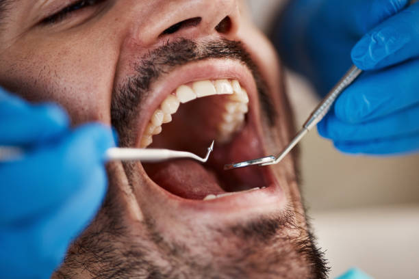Best Emergency Gum Pain Relief  in Blackwell, OK