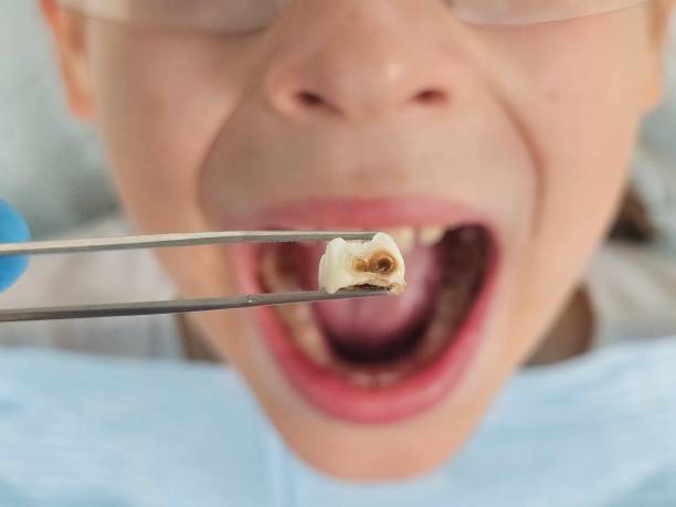 Best Tooth Pain Emergency Relief  in Blackwell, OK